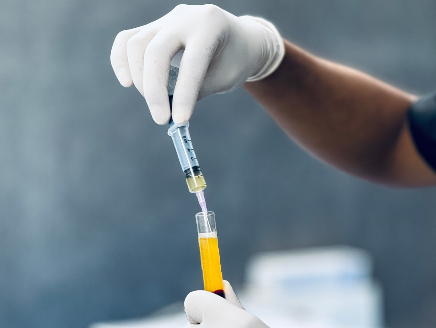 PRP treatment procedure